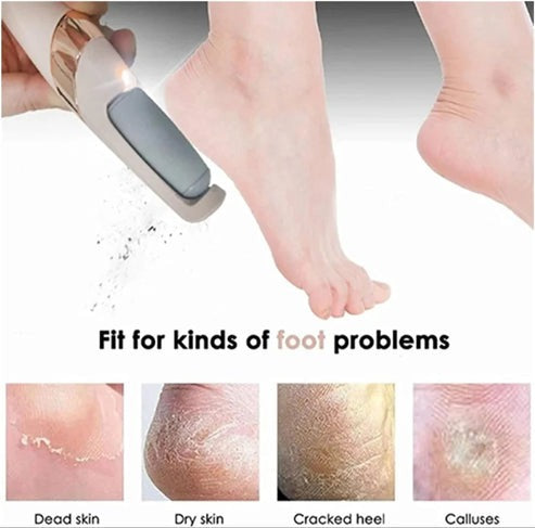 Flawless Electric Leg Skin Remover