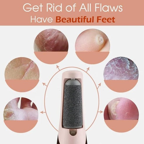 Flawless Electric Leg Skin Remover